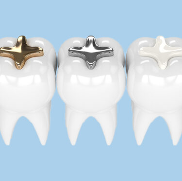dental filling treatment